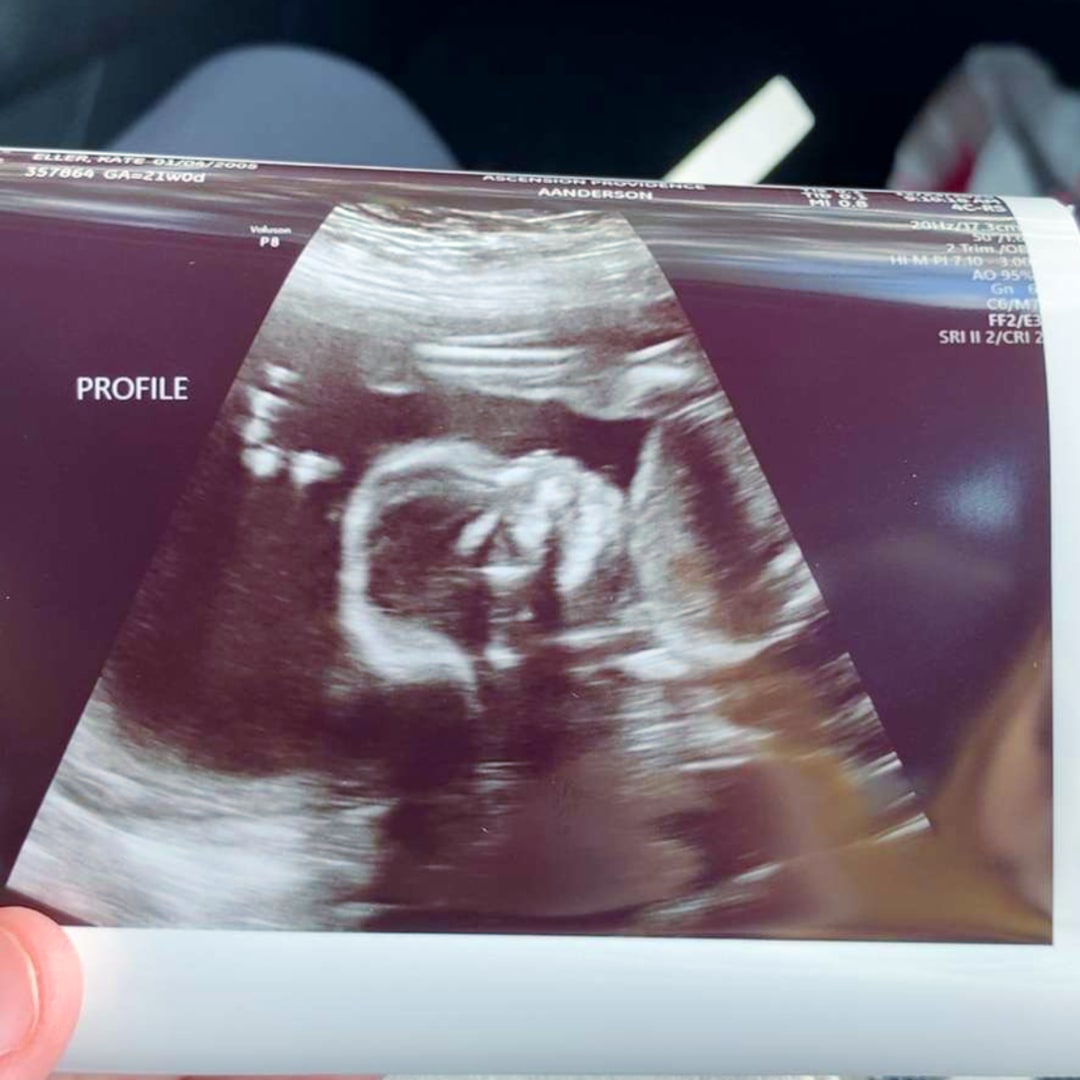 Photo shared by Kate for their Babylist baby registry.