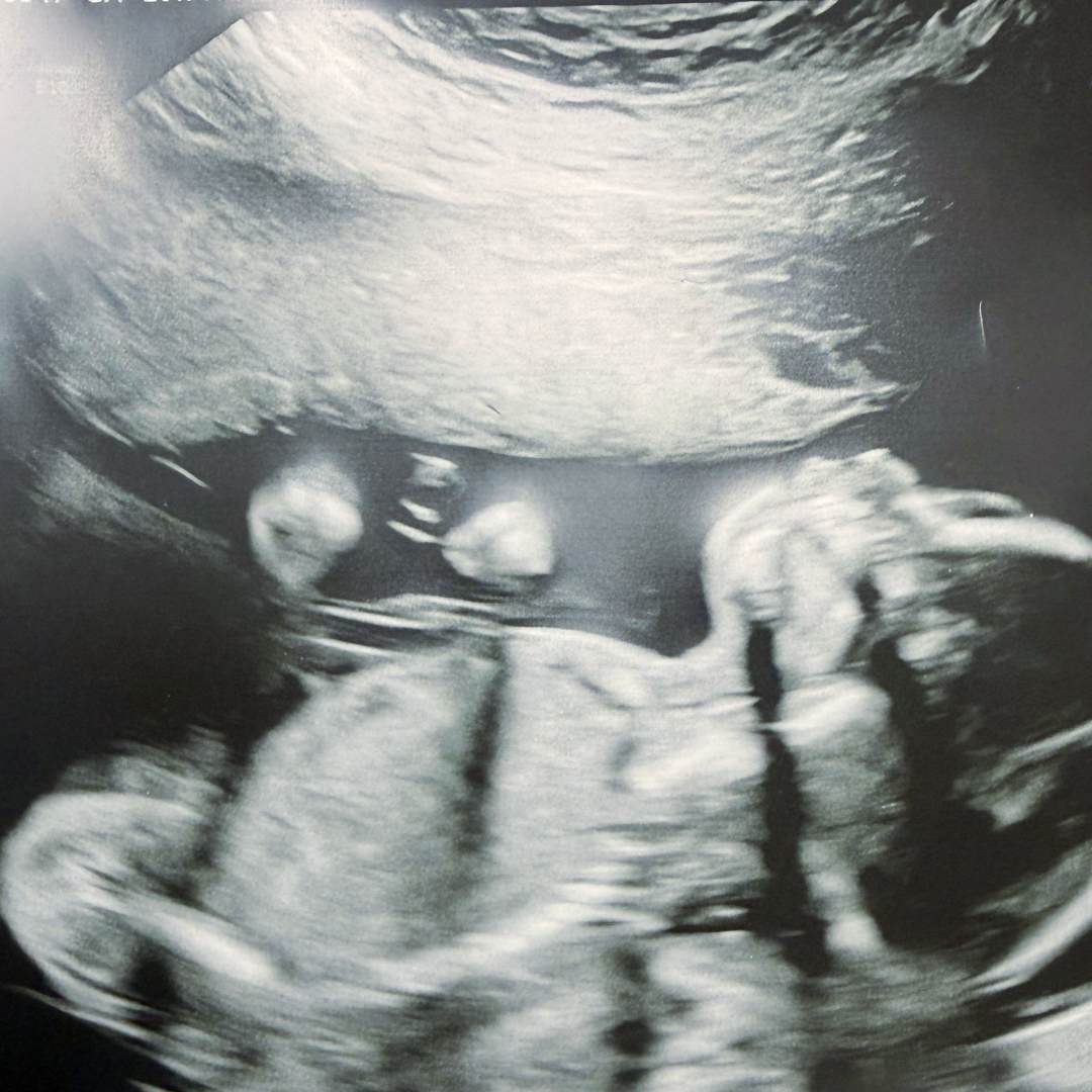 Photo shared by Jacqueline for their Babylist baby registry.