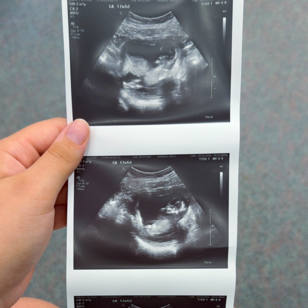Photo shared by Alliyah for their Babylist baby registry.