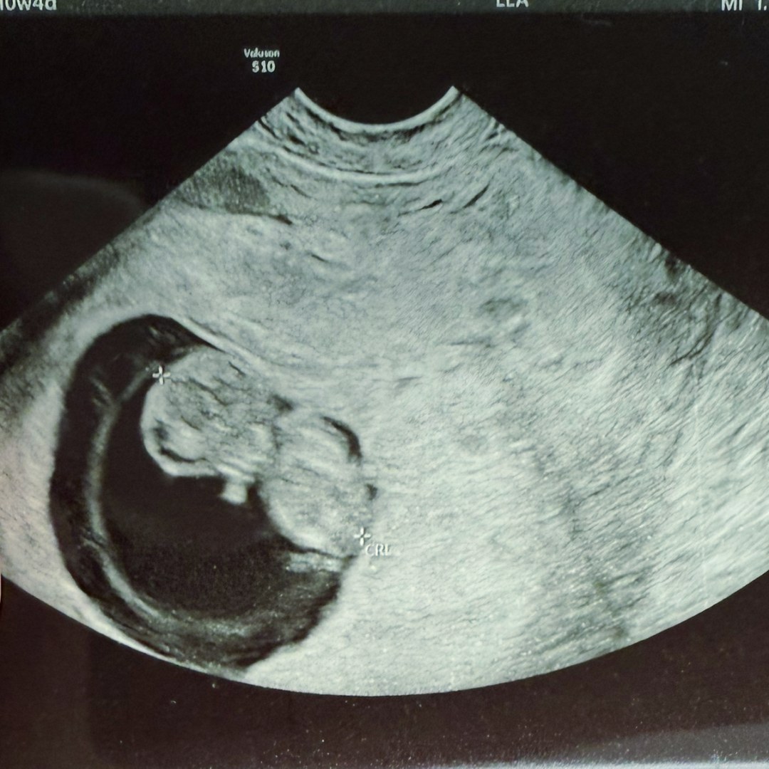 Photo shared by Deidre for their Babylist baby registry.