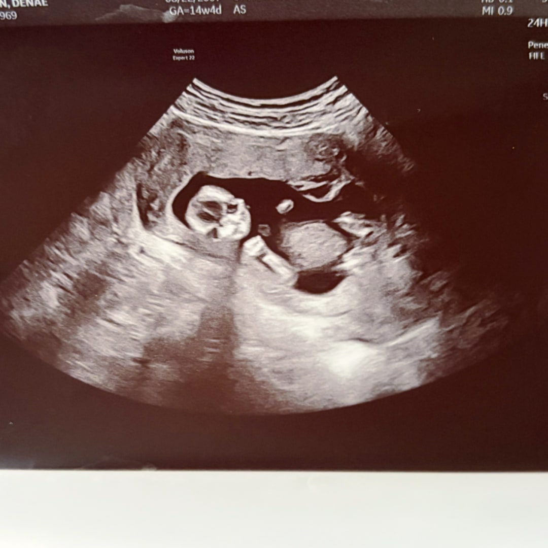 Photo shared by Denae for their Babylist baby registry.