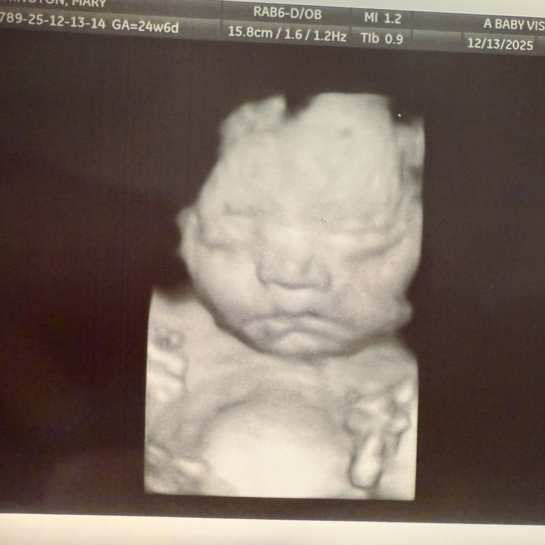 Photo shared by Mary for their Babylist baby registry.