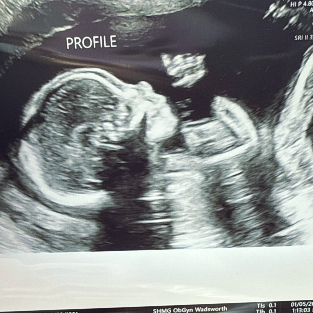 Photo shared by Brandi for their Babylist baby registry.