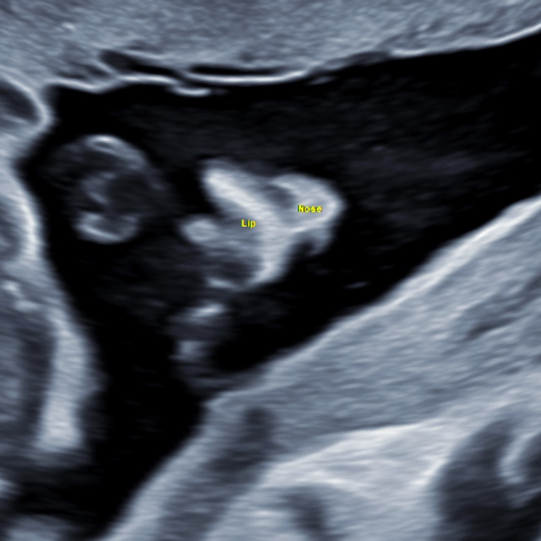 Photo shared by Evelyn for their Babylist baby registry.