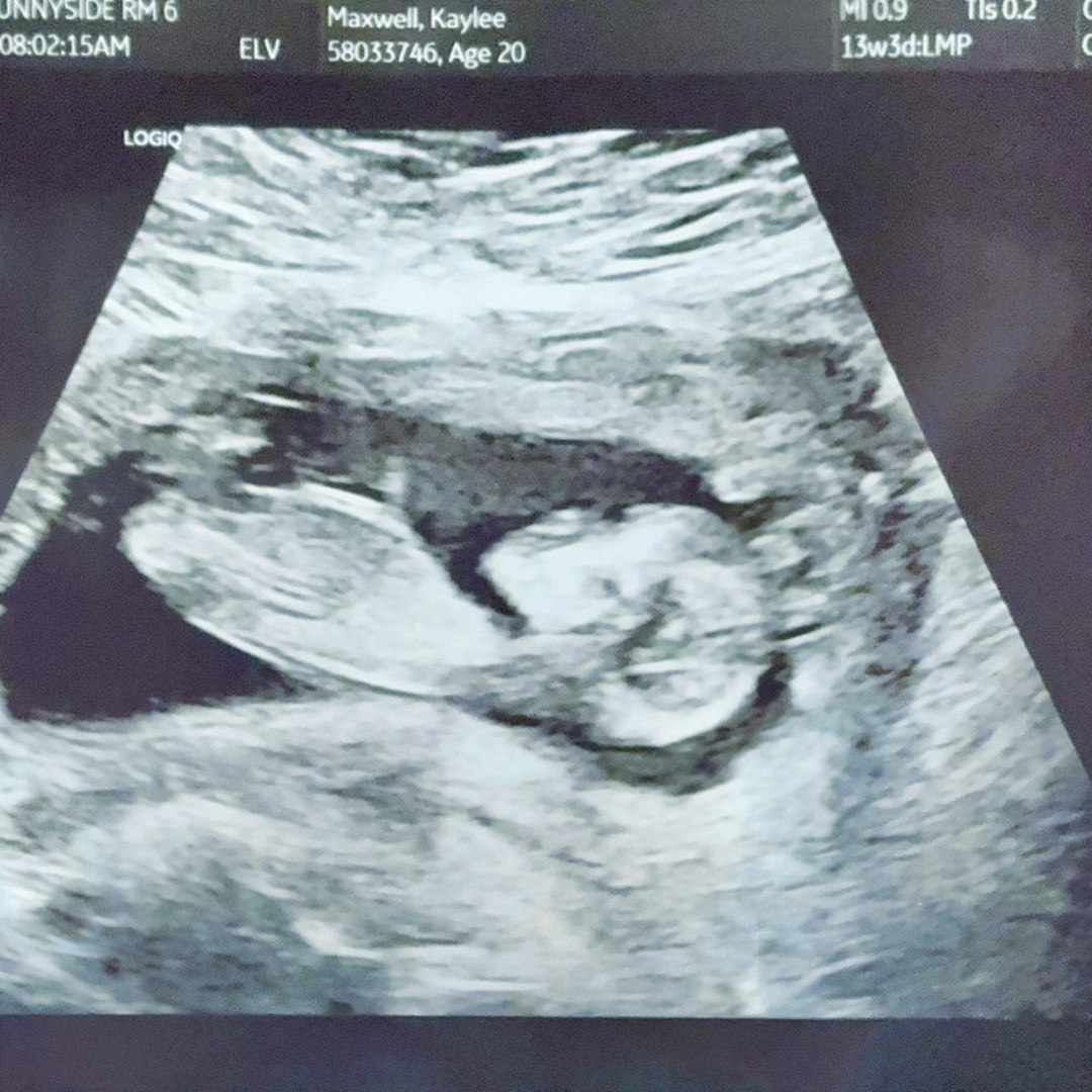 Photo shared by Kaylee for their Babylist baby registry.
