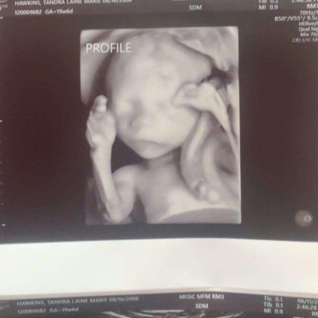 Photo shared by Tandra for their Babylist baby registry.