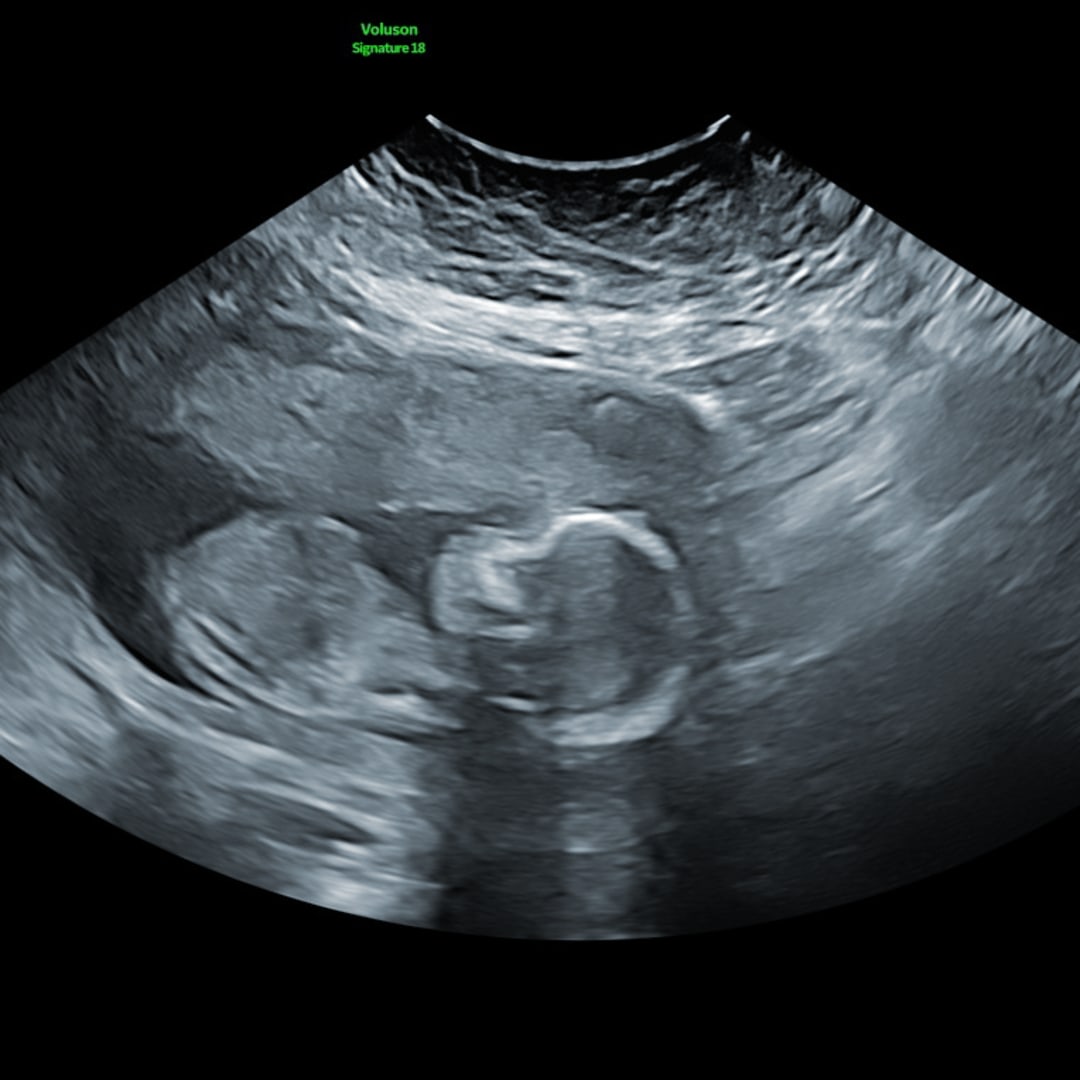 Photo shared by Savannah for their Babylist baby registry.