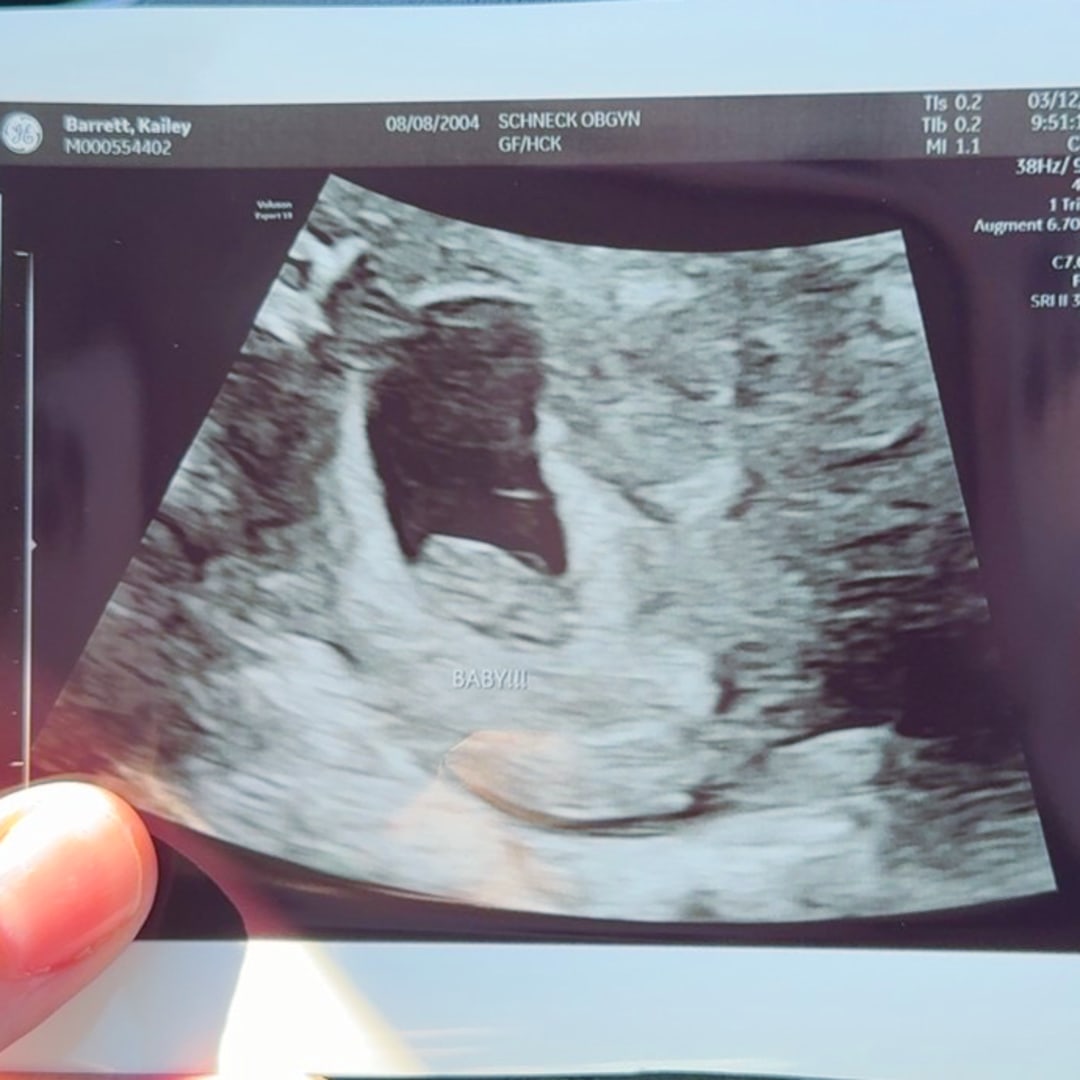 Photo shared by Kailey for their Babylist baby registry.