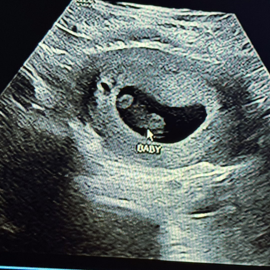 Photo shared by Jeniffer for their Babylist baby registry.