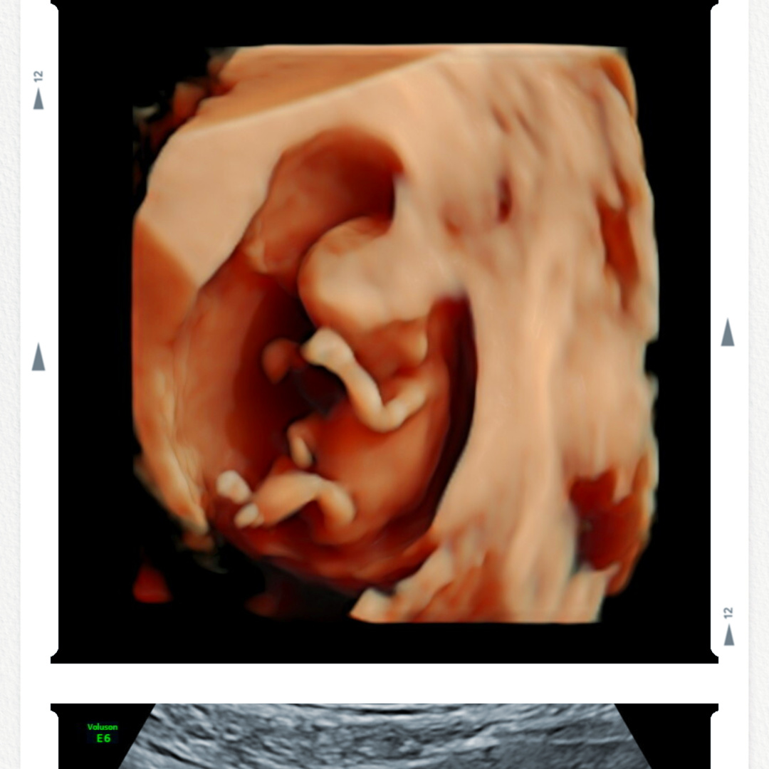 Photo shared by Melissa for their Babylist baby registry.