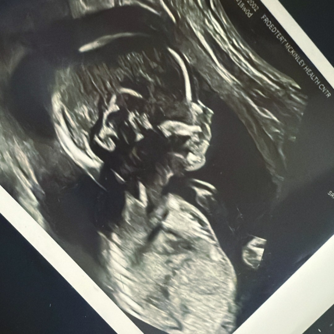 Photo shared by Cece for their Babylist baby registry.