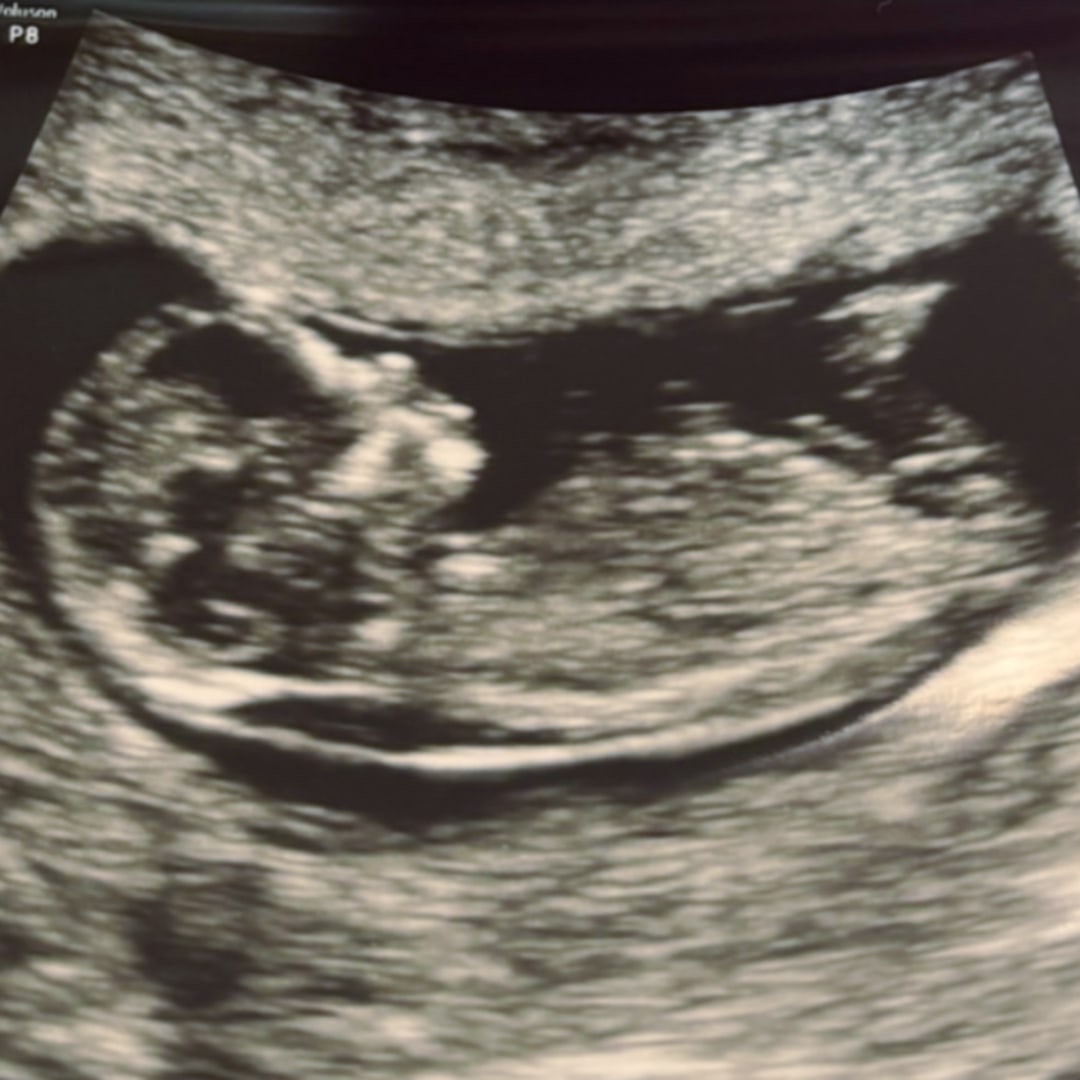 Photo shared by Jessica for their Babylist baby registry.