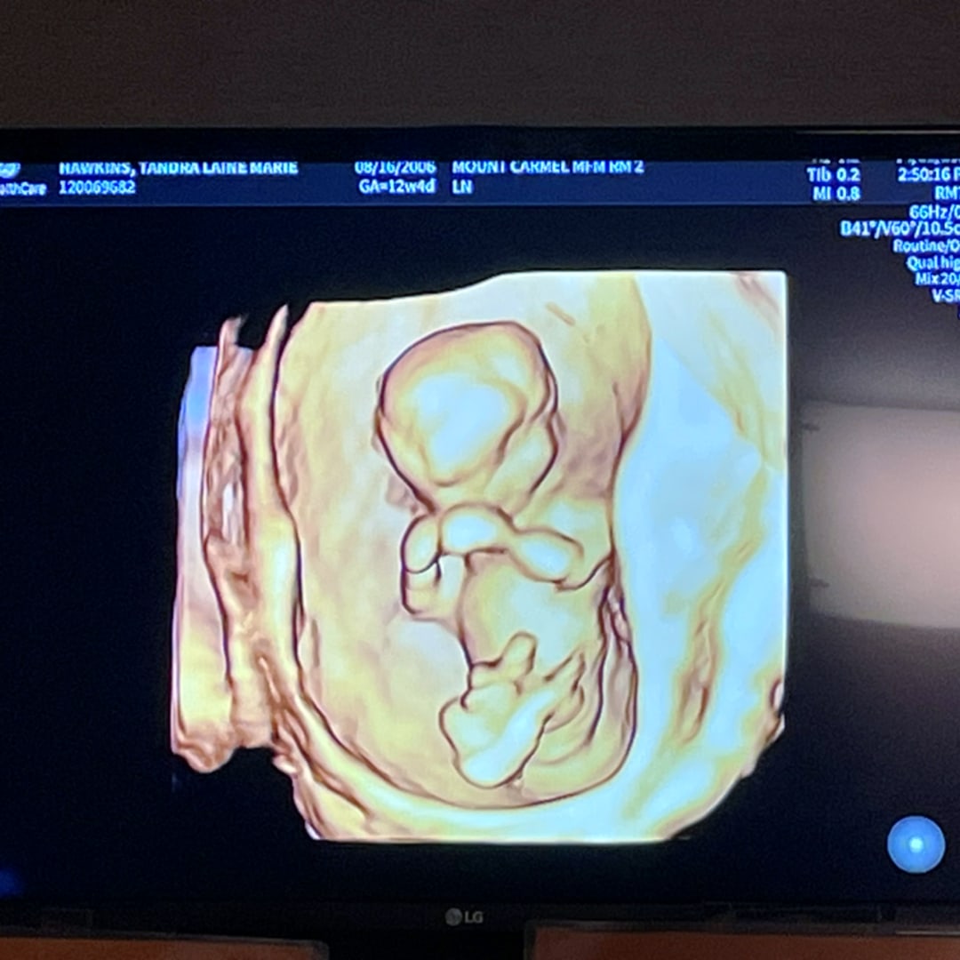 Photo shared by Tandra for their Babylist baby registry.