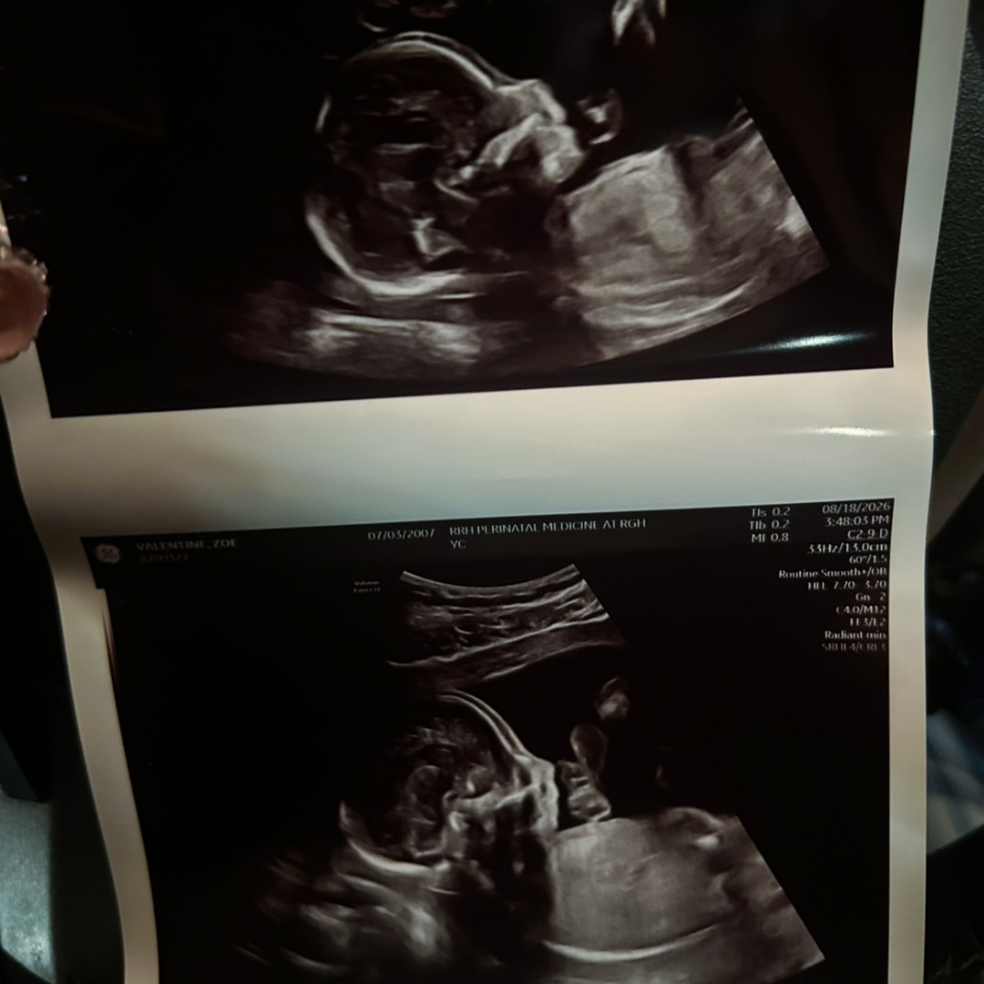 Photo shared by Zoe for their Babylist baby registry.