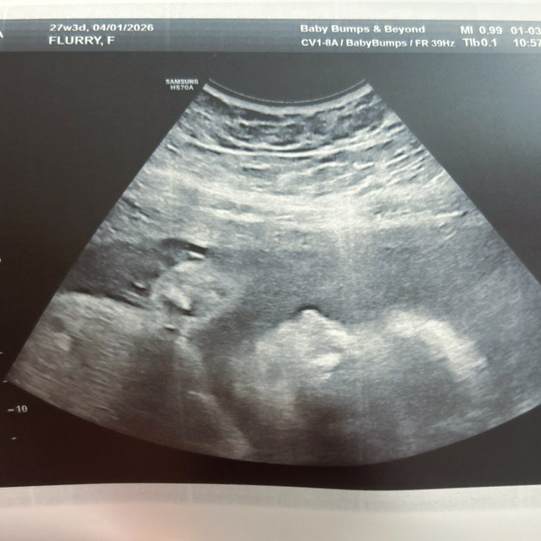 Photo shared by Will and Faith for their Babylist baby registry.