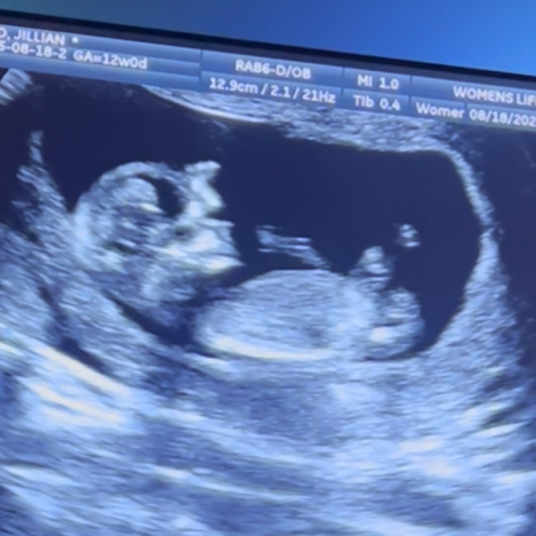 Photo shared by Jillian for their Babylist baby registry.
