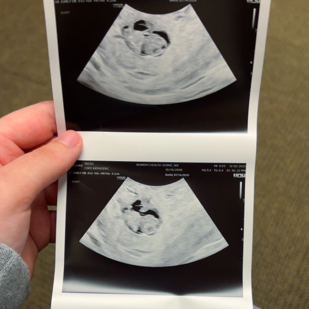 Photo shared by Kathleen for their Babylist baby registry.