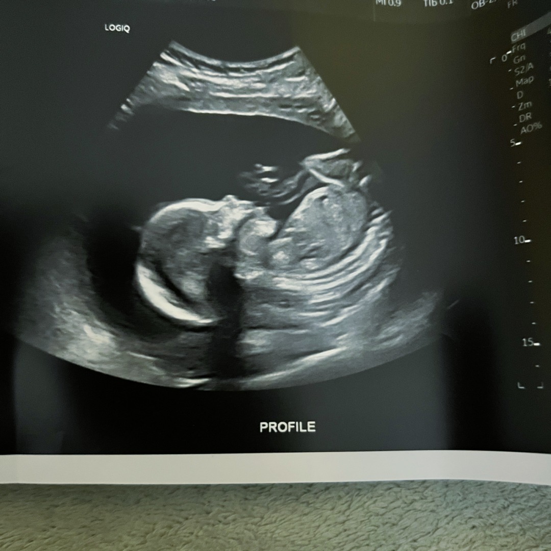 Photo shared by Tyler for their Babylist baby registry.