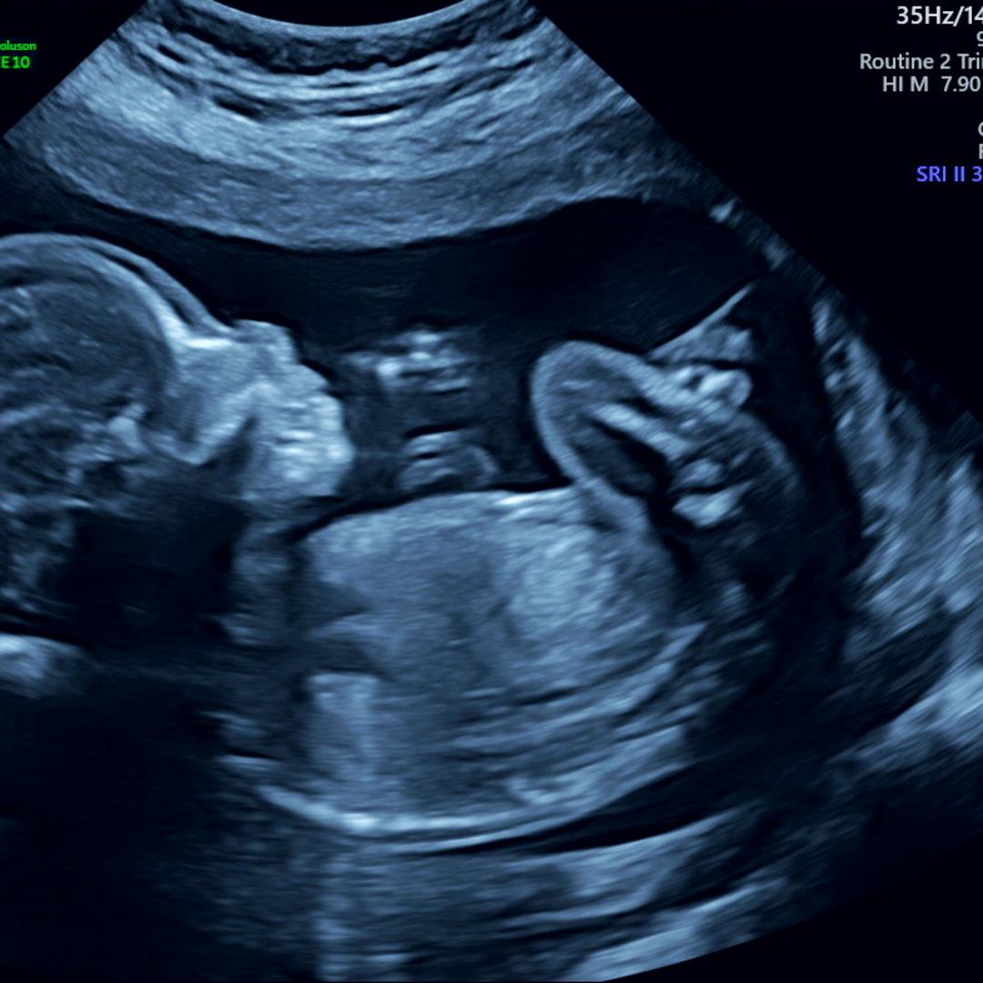 Photo shared by Keilanie for their Babylist baby registry.