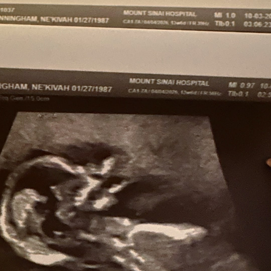 Photo shared by Nekivah Marie for their Babylist baby registry.