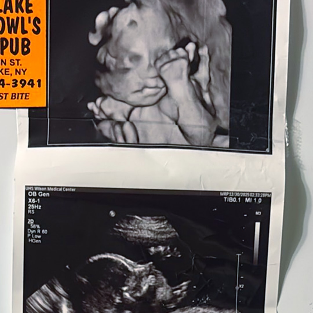 Photo shared by Daisy for their Babylist baby registry.