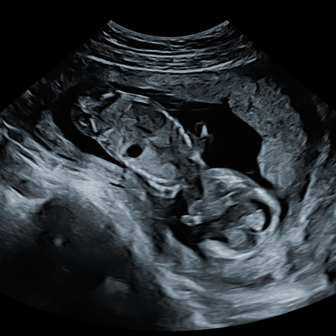 Photo shared by A for their Babylist baby registry.