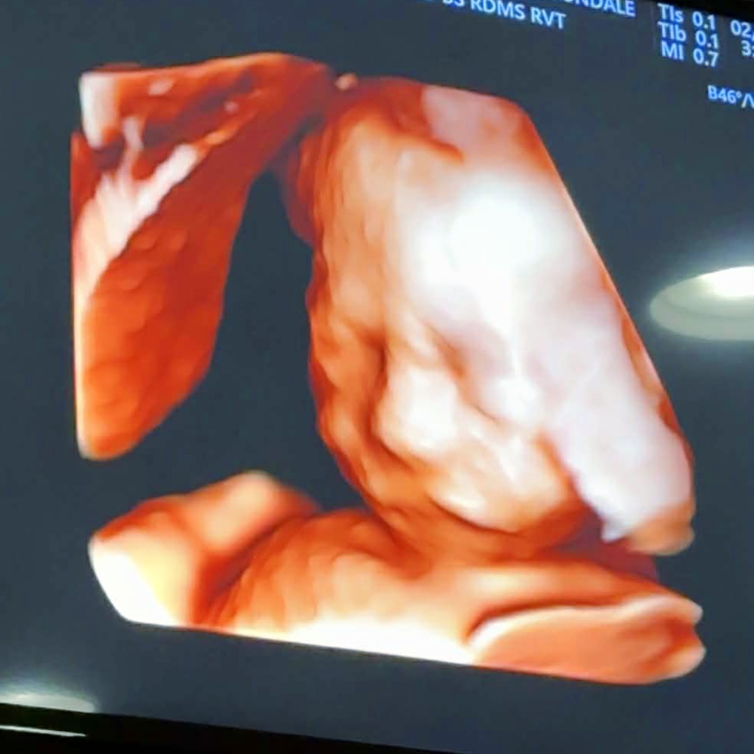 Photo shared by Bea Rose for their Babylist baby registry.