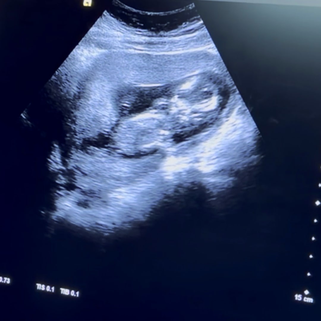 Photo shared by Carla for their Babylist baby registry.