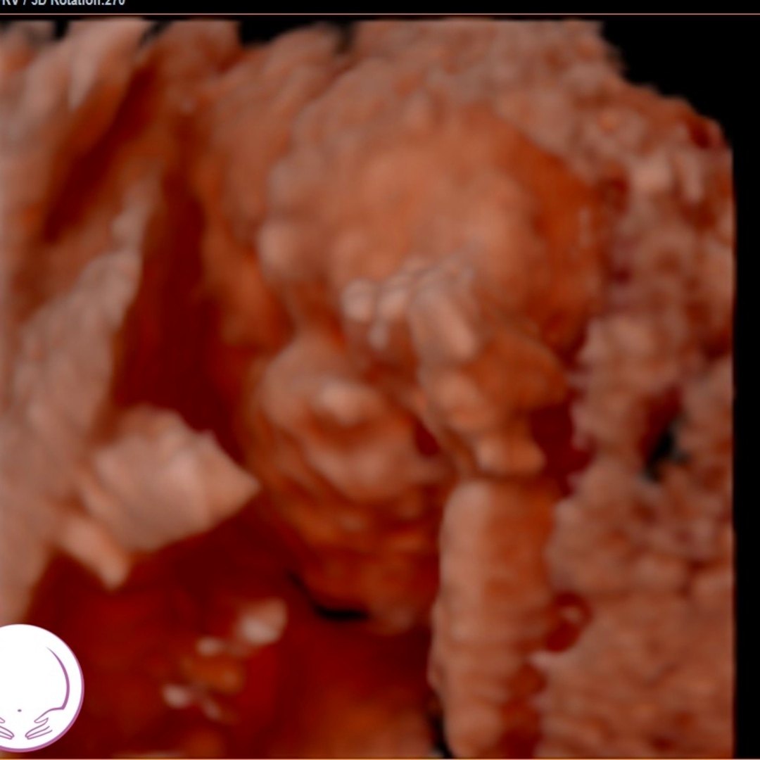 Photo shared by Jessamaine for their Babylist baby registry.