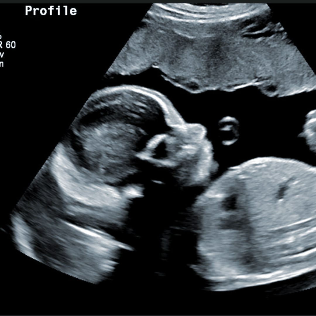 Photo shared by Alexis for their Babylist baby registry.