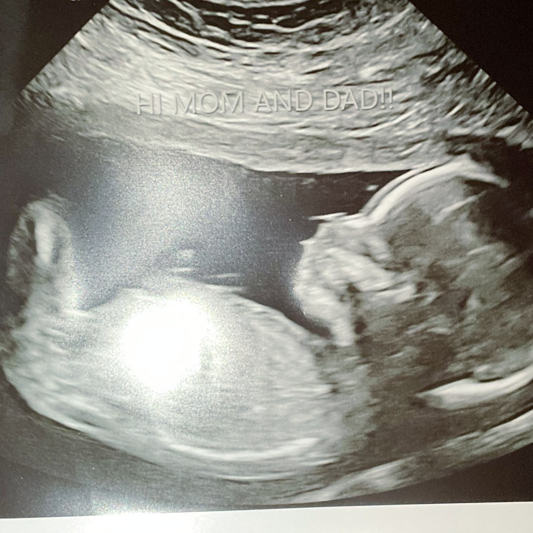 Photo shared by Rachel for their Babylist baby registry.