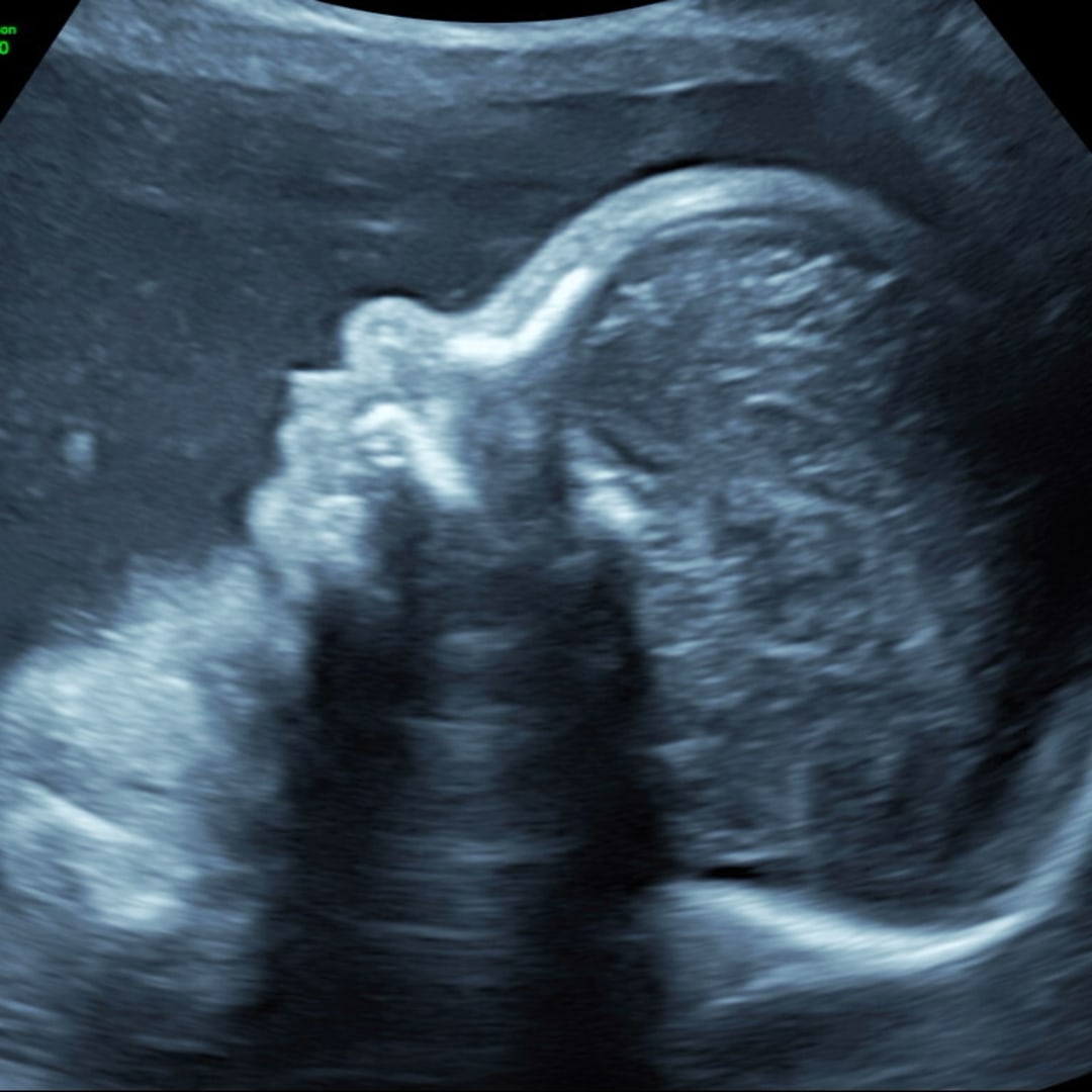Photo shared by Makayla for their Babylist baby registry.