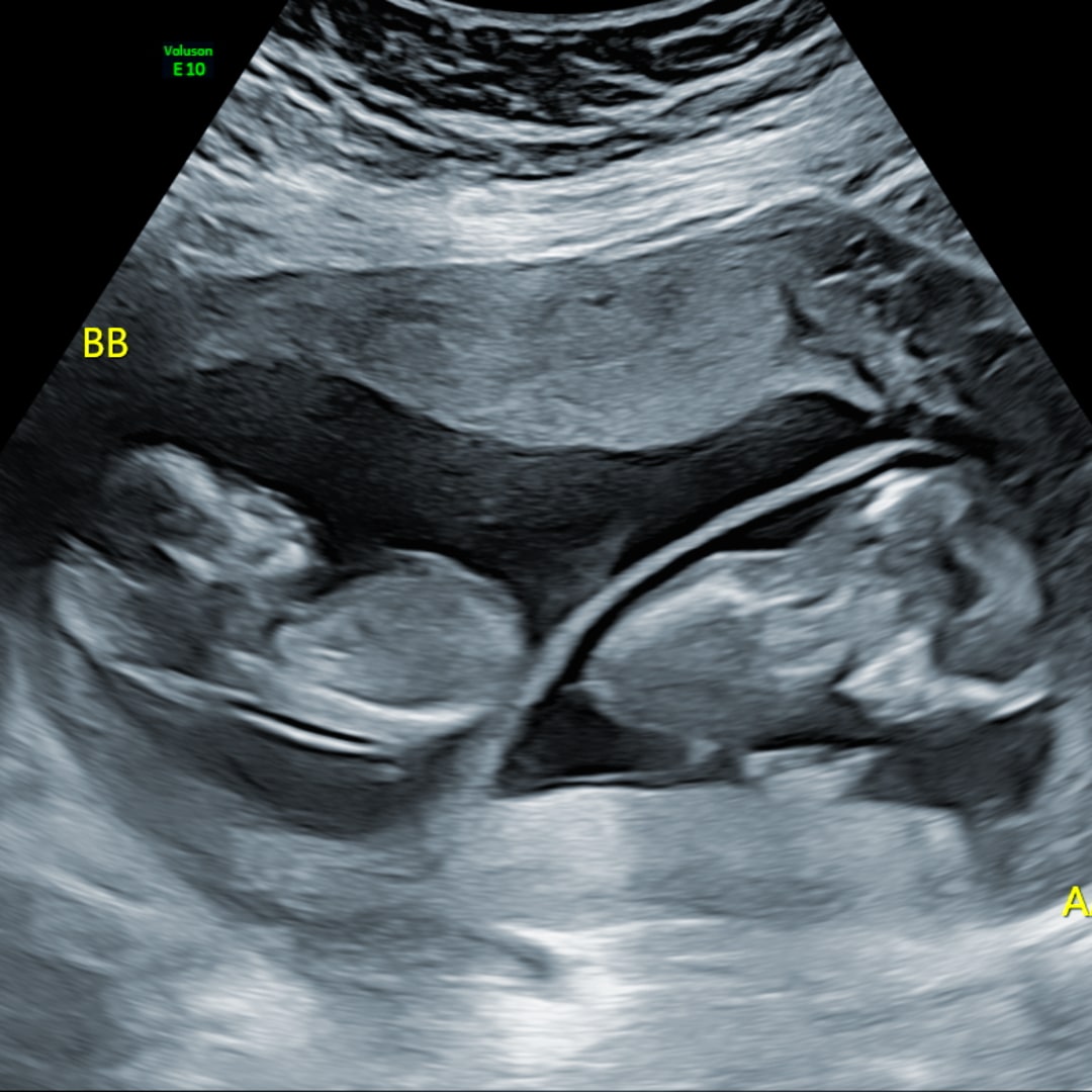 Photo shared by Casey for their Babylist baby registry.