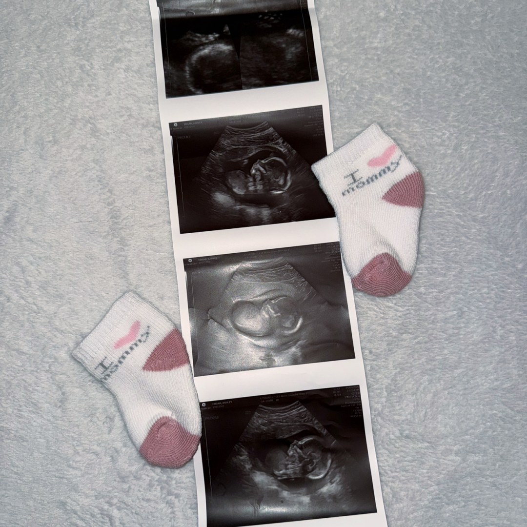 Photo shared by Ashley for their Babylist baby registry.