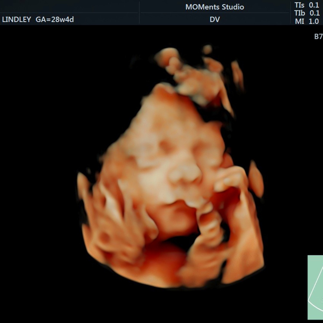 Photo shared by Haley for their Babylist baby registry.