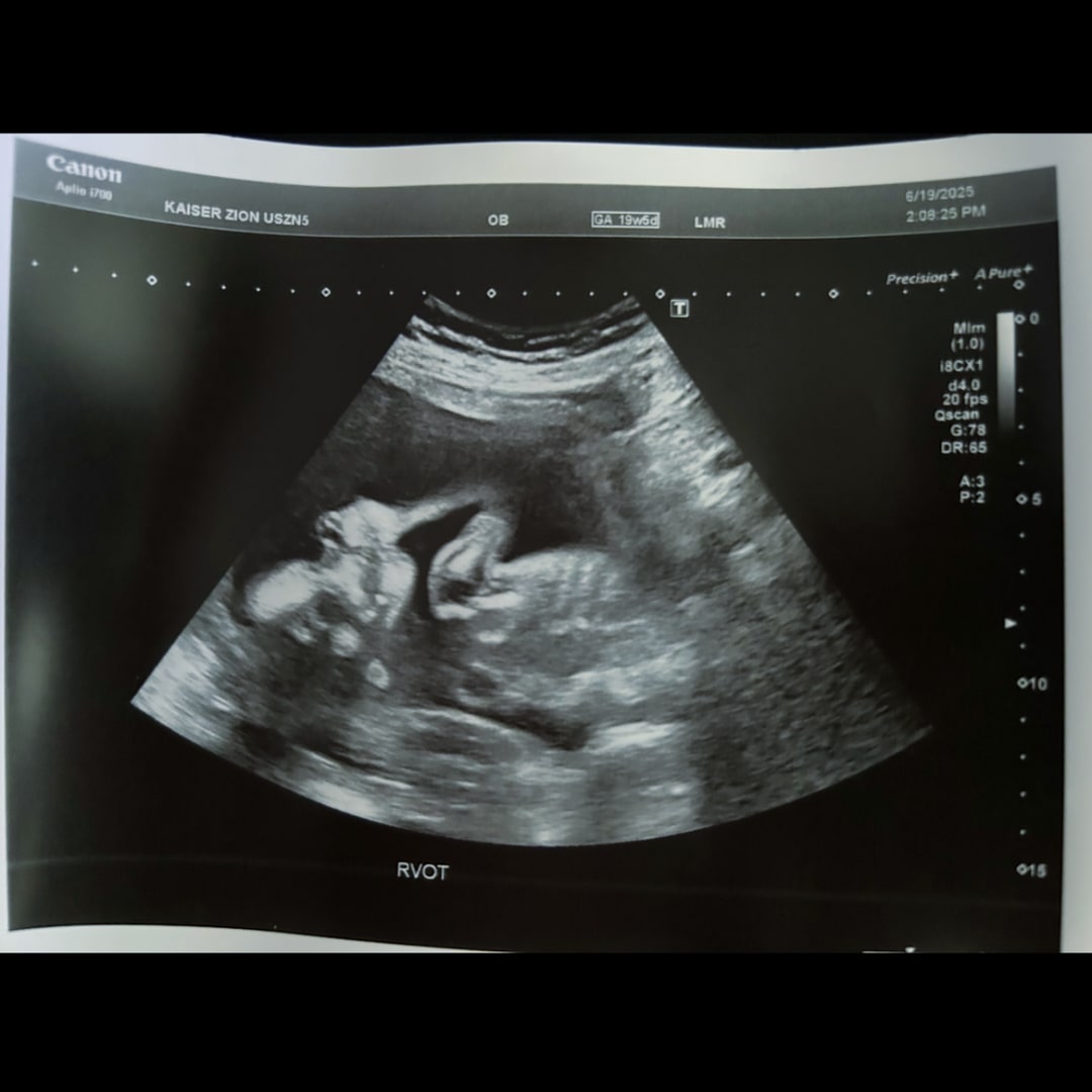 Photo shared by Asaja for their Babylist baby registry.