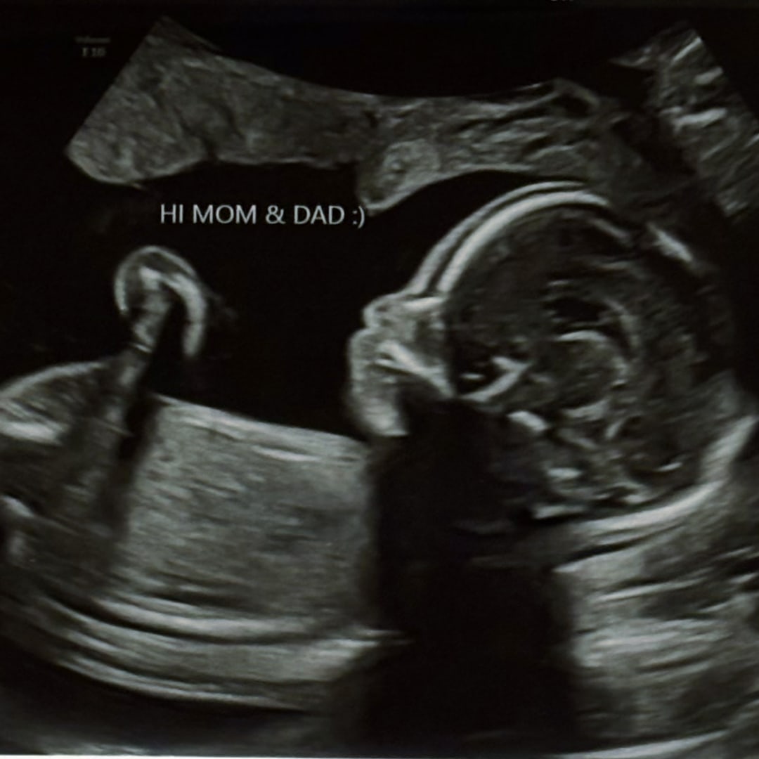 Photo shared by Annie for their Babylist baby registry.