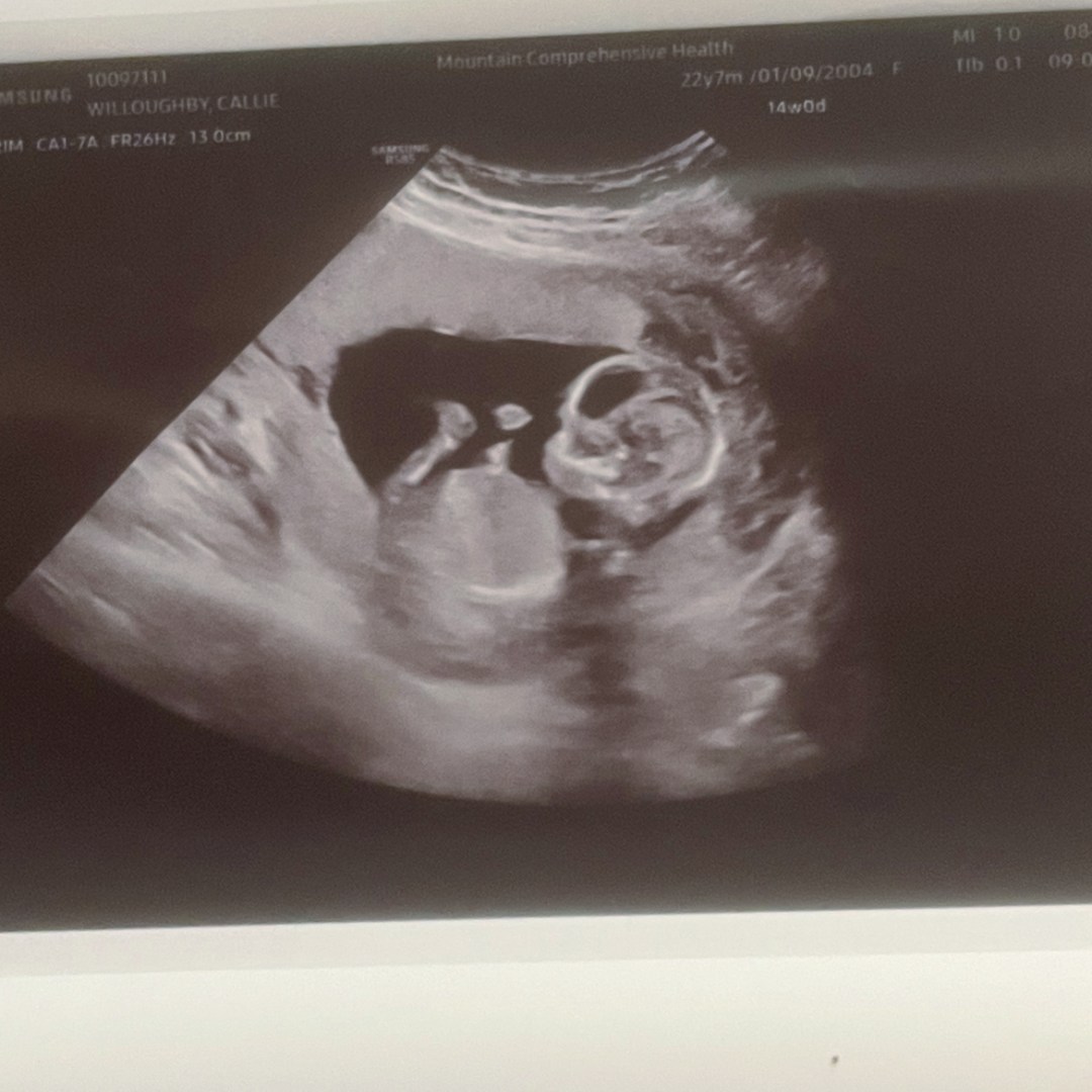 Photo shared by Callie for their Babylist baby registry.