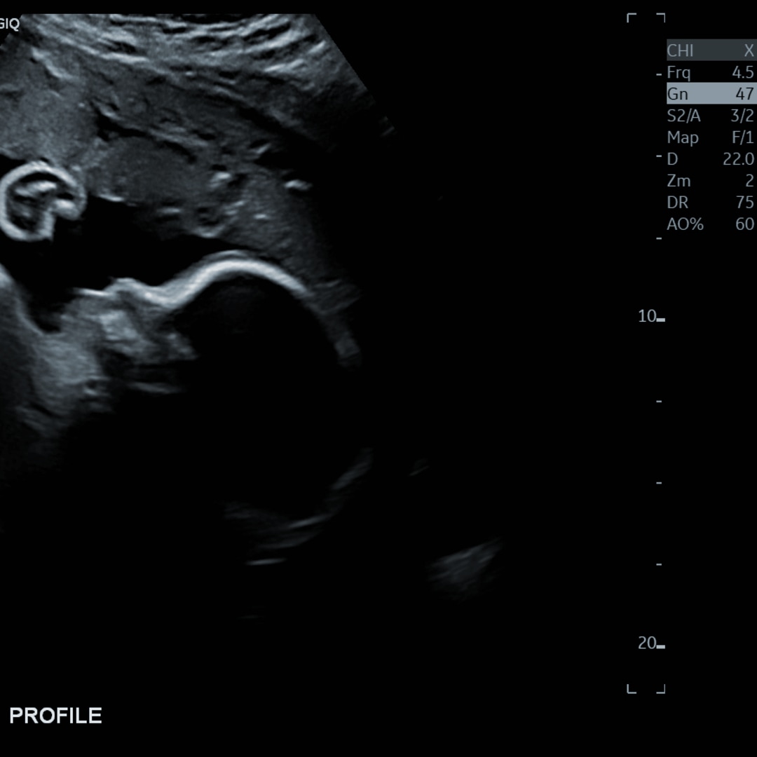 Photo shared by Justice for their Babylist baby registry.