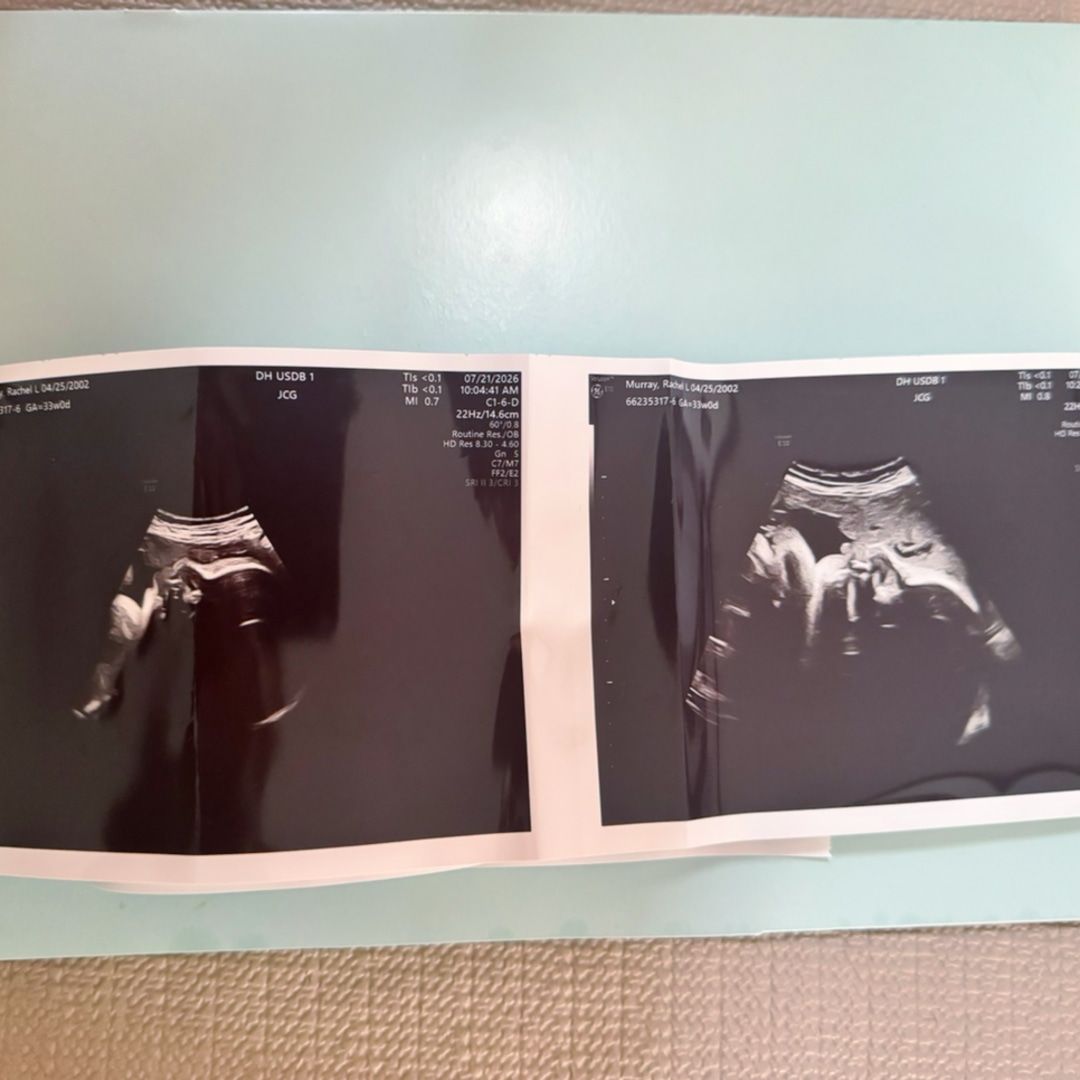 Photo shared by Rachel for their Babylist baby registry.