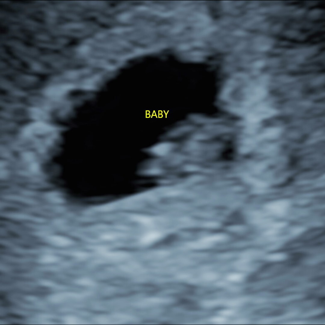 Photo shared by Cassi for their Babylist baby registry.
