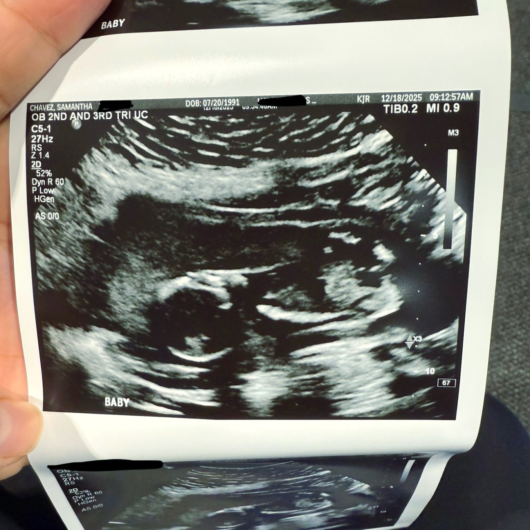 Photo shared by Sammie for their Babylist baby registry.