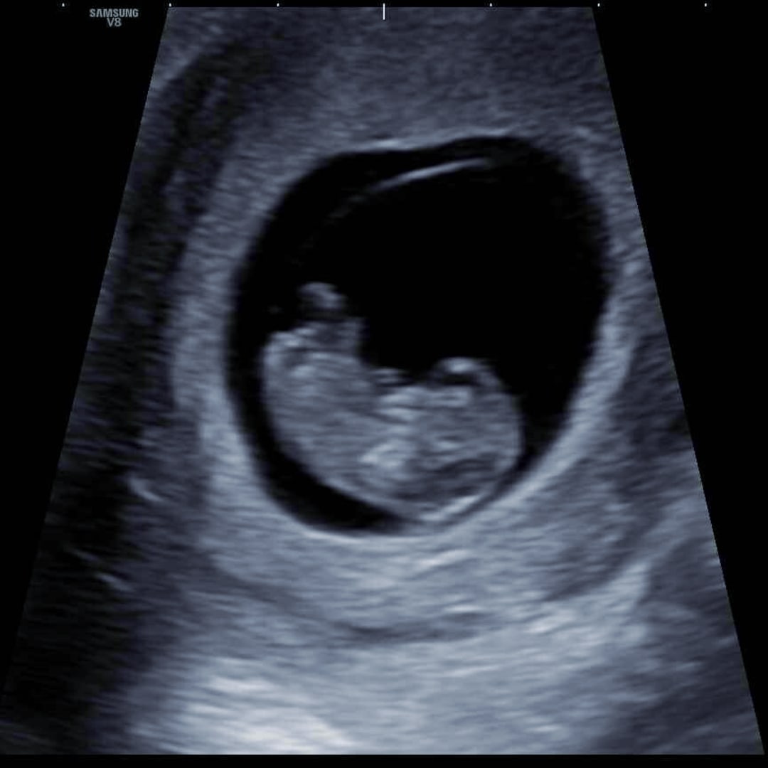 Photo shared by Anne for their Babylist baby registry.