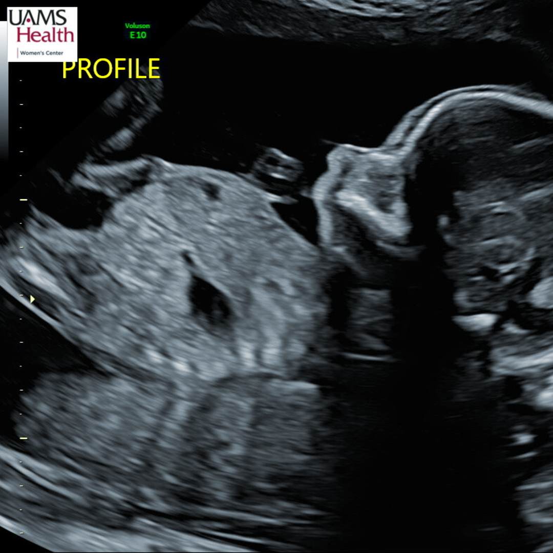 Photo shared by Lynda for their Babylist baby registry.