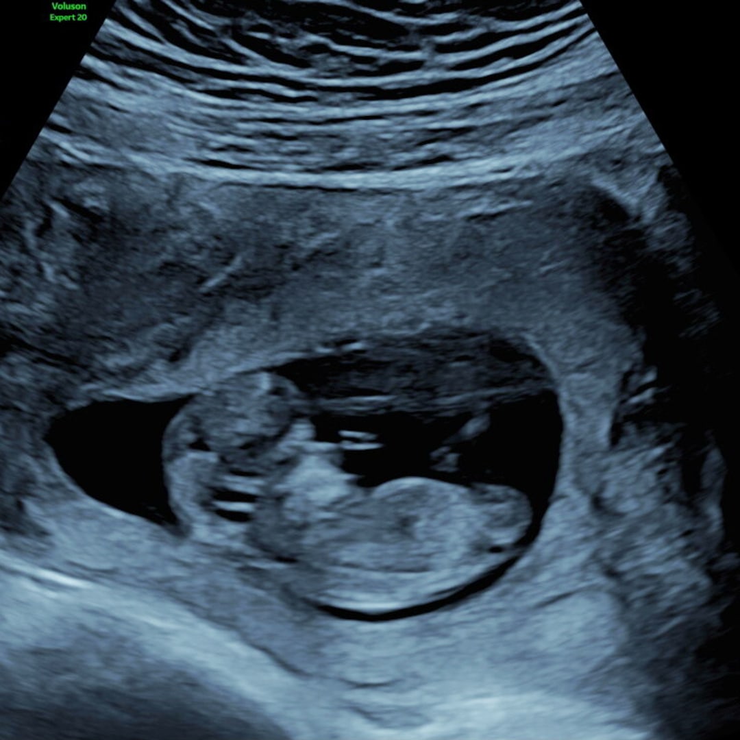 Photo shared by Kaylee for their Babylist baby registry.