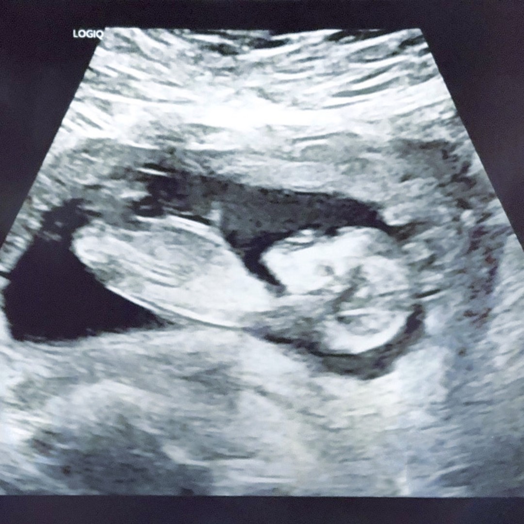 Photo shared by Kaylee for their Babylist baby registry.