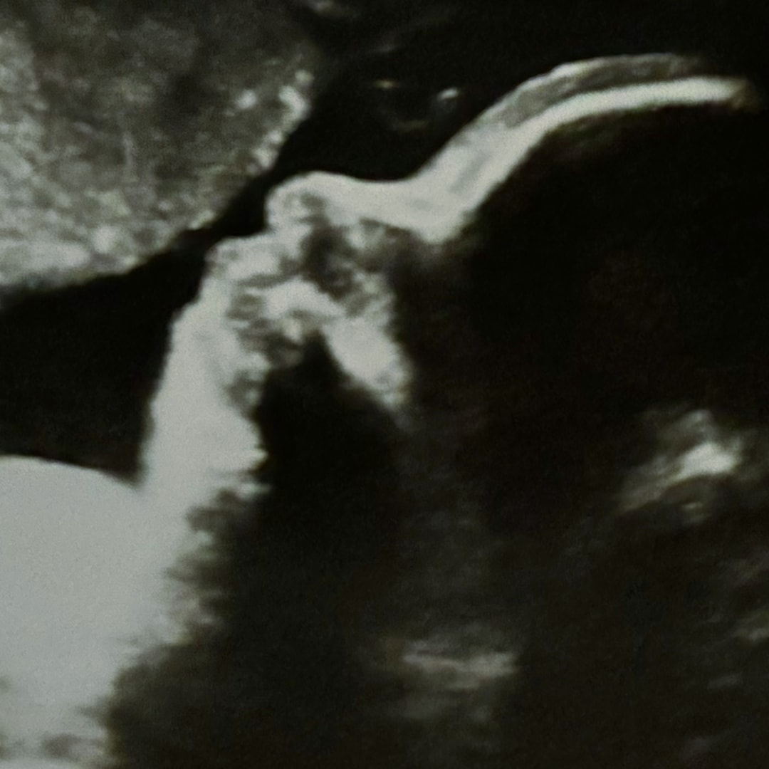 Photo shared by 𝑲𝒚𝒓𝒂 for their Babylist baby registry.