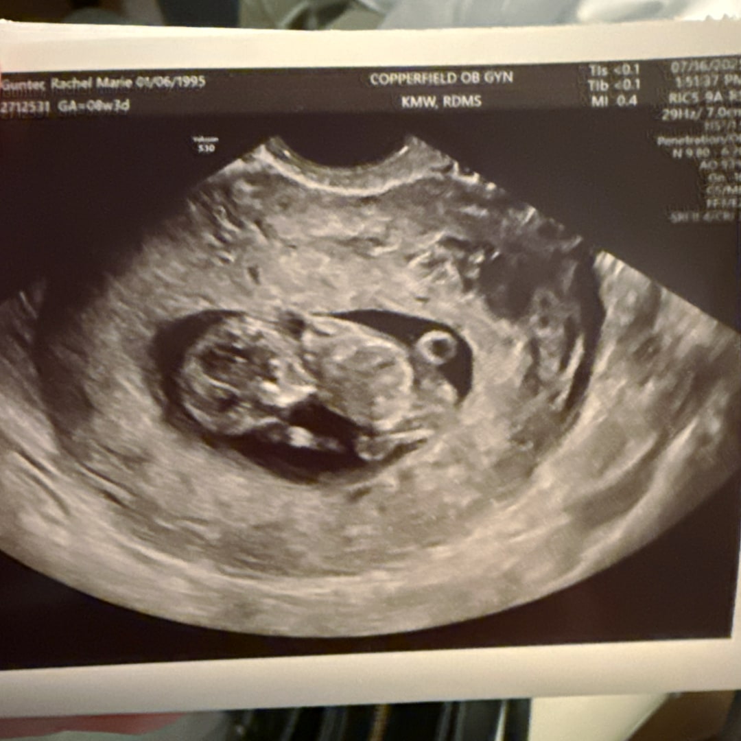 Photo shared by Rachel for their Babylist baby registry.