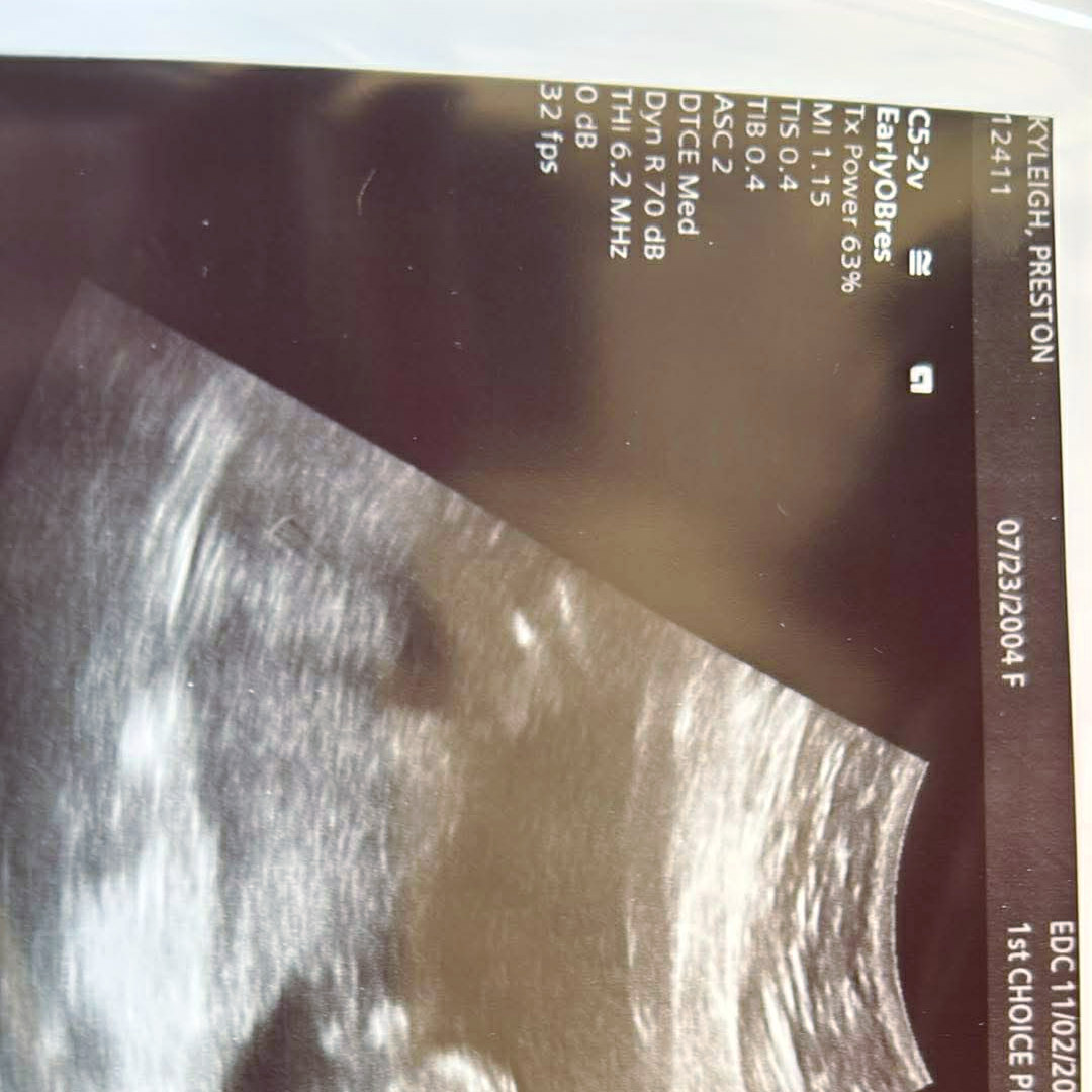 Photo shared by Kyleigh for their Babylist baby registry.