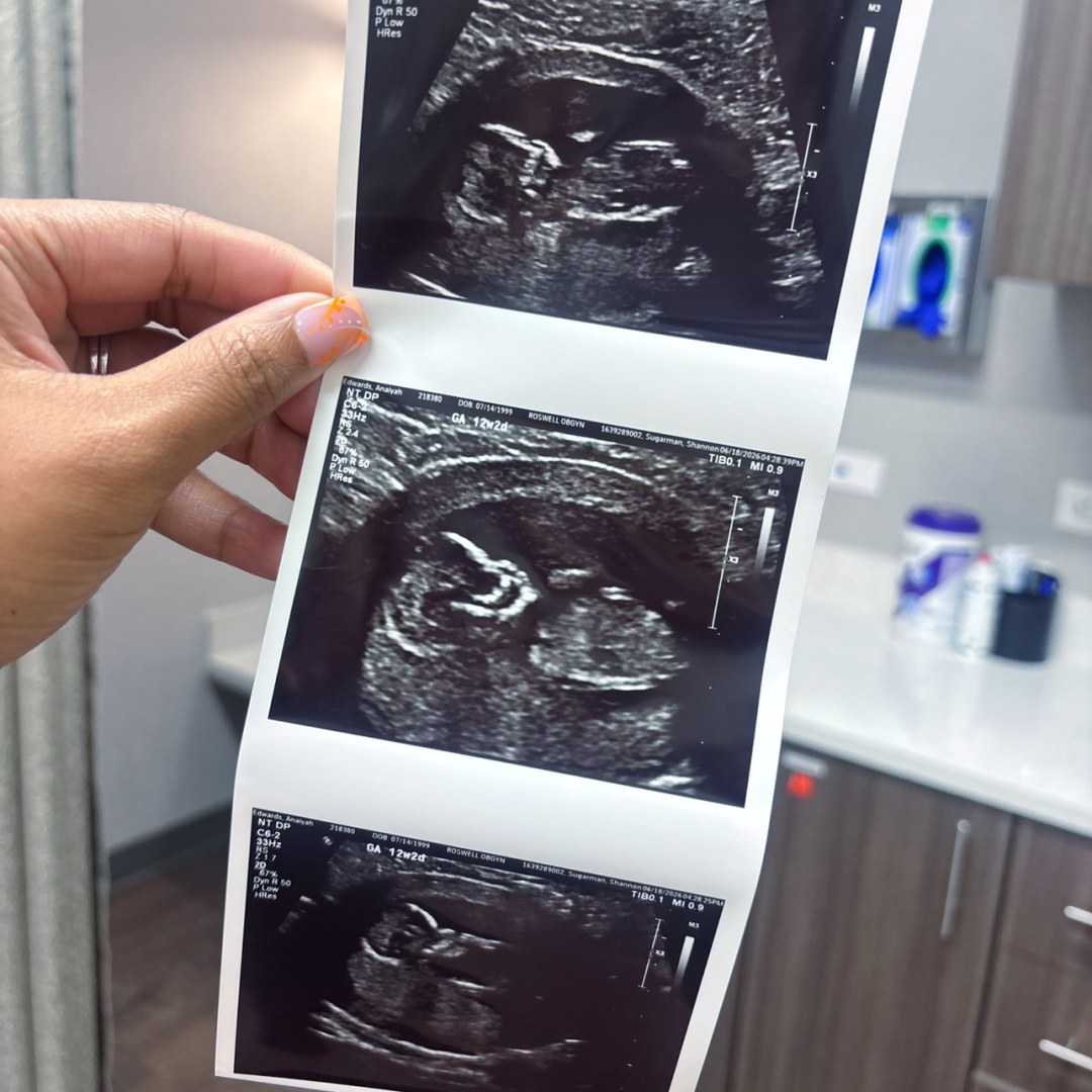 Photo shared by Anaiyah for their Babylist baby registry.